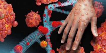 Africa Will Declare a Mpox Public Health Emergency