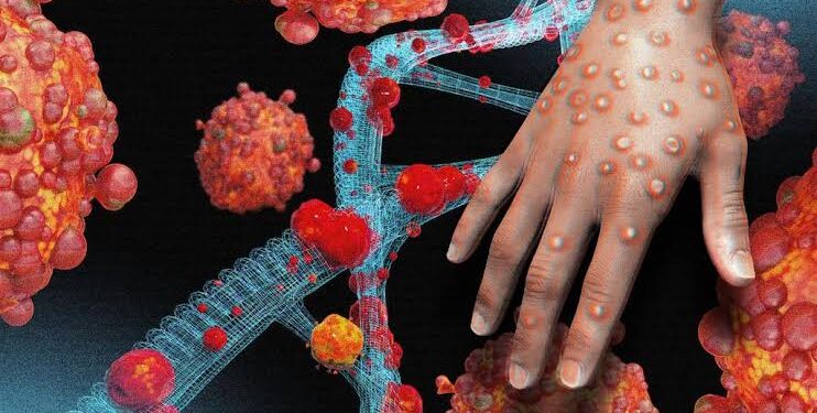 Africa Will Declare a Mpox Public Health Emergency