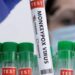 The 2024 Mpox Outbreak: History, Symptoms, and Mode of Transmission