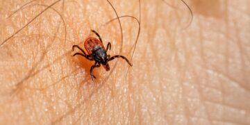 Lyme, The Tick-Borne Disease: Occurrence, Symptoms, and Risk Factors