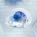 Cerebrospinal Fluid Drainage: Top 2 Methods Used In Cerebrospinal Fluid Drainage