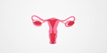 Basic Things To Know About Ovarian Torsion