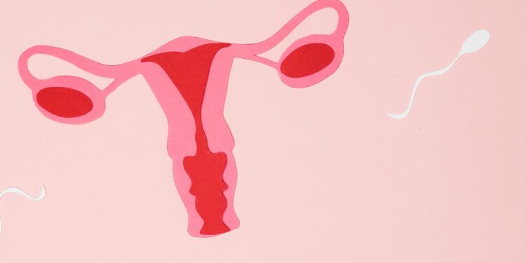Risk of Getting Ovarian Torsion, How to Identify and Treat Ovarian Torsion: A Comprehensive Guide