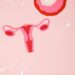 Risk of Getting Ovarian Torsion, How to Identify and Treat Ovarian Torsion: A Comprehensive Guide