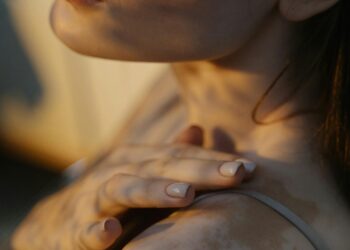 Life With Vitiligo: How To Navigate, and Treatment Options