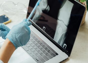 Bone Metastasis: Symptoms, Types and Causes