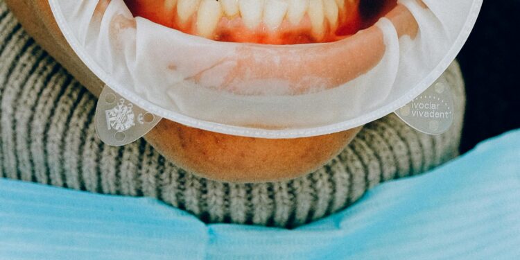 “Why Do I Have Bleeding Gum?” Common Causes Explained