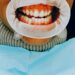 “Why Do I Have Bleeding Gum?” Common Causes Explained