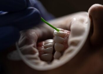 Home Remedies and Dental Treatment For Tooth Sensitivity