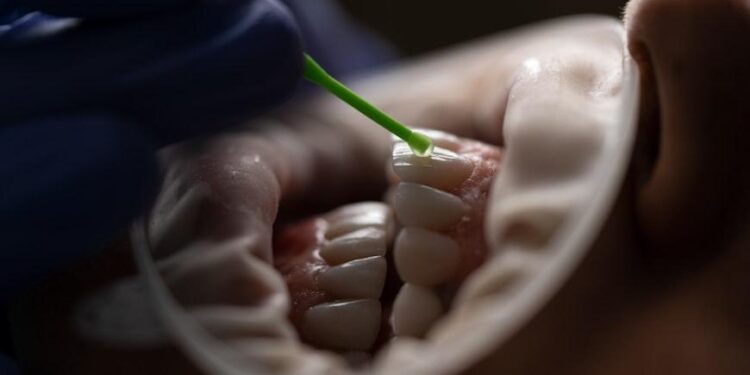 Home Remedies and Dental Treatment For Tooth Sensitivity