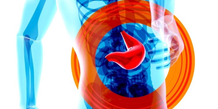 Melena: Symptoms and Causes of Dark Stools