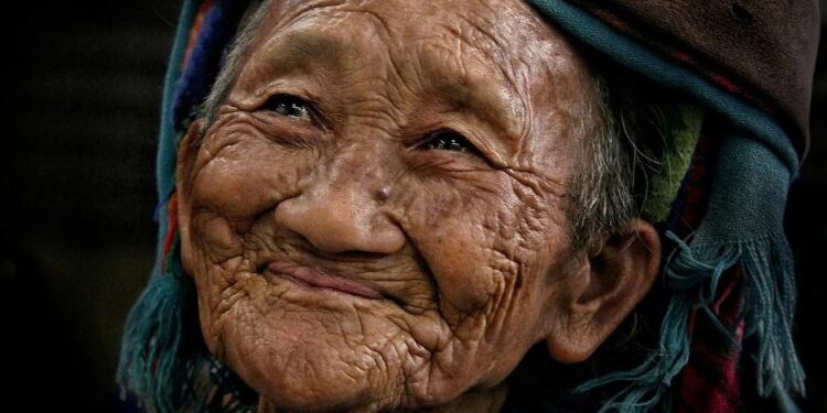 Top 6 Reasons For Orbital Fat