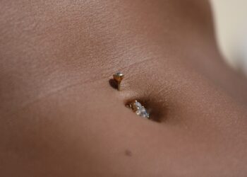 Umbilical Hernia: Types, Symptoms, and Causes