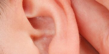 Hearing Loss: Types, Symptoms, and Causes