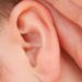 Hearing Loss: Types, Symptoms, and Causes