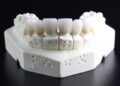 Wisdom Teeth: Anatomy, Function, Symptoms and Causes of Wisdom Teeth Problems