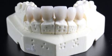 Wisdom Teeth: Anatomy, Function, Symptoms and Causes of Wisdom Teeth Problems