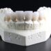 Wisdom Teeth: Anatomy, Function, Symptoms and Causes of Wisdom Teeth Problems
