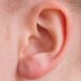 Hearing Loss: Treatment and Prevention