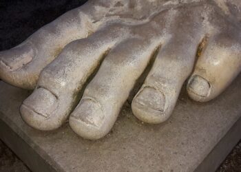 Ingrown Toenail: Symptoms, Causes, and Complications