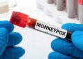 Morocco Records First Mpox Case, Government Plays Mysterious