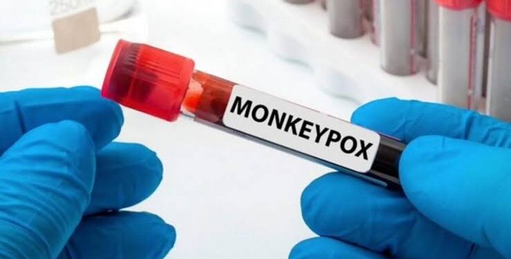 Morocco Records First Mpox Case, Government Plays Mysterious