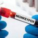 Morocco Records First Mpox Case, Government Plays Mysterious