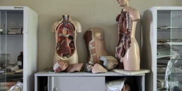 Liver Lesions: Symptoms, Causes, and Process