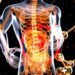 Liver Lesions: Prevention and Treatment