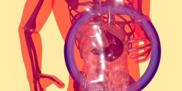 Dumping Syndrome and Its Types