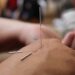 The Pinch Balance Technique Will Help You Feel Less Stressed