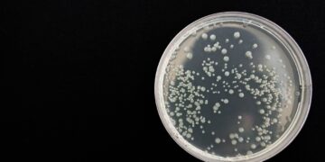 Listeria Contamination: What You Need to Know