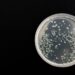 Listeria Contamination: What You Need to Know