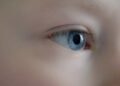 Corneal Abrasion: Function of the Cornea, Symptoms, and Causes of Corneal Abrasion