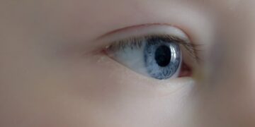 Corneal Abrasion: Function of the Cornea, Symptoms, and Causes of Corneal Abrasion