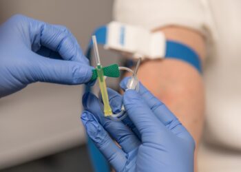 Vein Dilation: Causes, and Symptoms