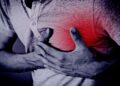 Coronary Artery Disease (CAD): Process, Symptoms, and Causes