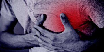Coronary Artery Disease (CAD): Process, Symptoms, and Causes