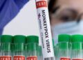 UK Confirms First Case of Highly Contagious Mpox Strain