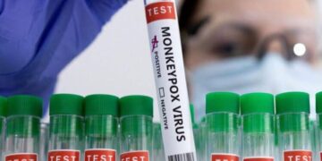 UK Confirms First Case of Highly Contagious Mpox Strain