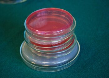 Listeria Contamination: What You Need to Know