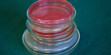 Listeria Contamination: What You Need to Know