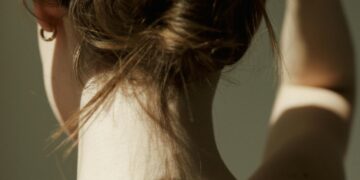 Quick and Easy Solutions for Getting Rid of Bacne