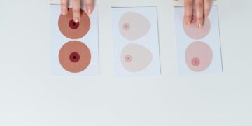 Breast Asymmetry: Types and Causes