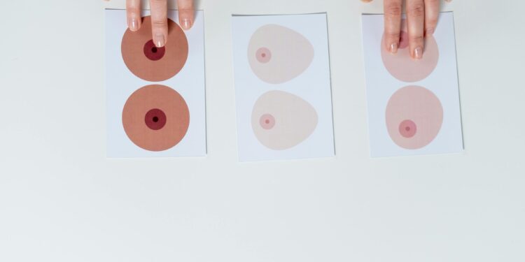 Breast Asymmetry: Types and Causes