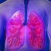 Acute Respiratory Distress Syndrome (ARDS): Process, Symptoms, and Causes