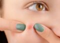 6 Unusual Factors Behind Your Breakouts