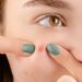 6 Unusual Factors Behind Your Breakouts