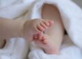 Anencephaly: What It Is, Symptoms, and Causes