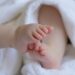 Anencephaly: What It Is, Symptoms, and Causes 